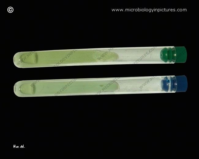 L�wenstein-Jensen and Ogawa medium